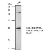 Solarbio K111854P Anti-IGLL1/IGLC1/IGLC6/IGLC7/IGLC2/IGLC3 Polyclonal Antibody