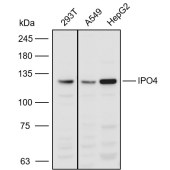 Solarbio K110952P Anti-IPO4 Polyclonal Antibody