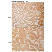 Solarbio K111045P Anti-MC4R Polyclonal Antibody