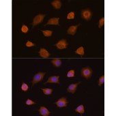 Solarbio K009920P Anti-PKM2 Polyclonal Antibody