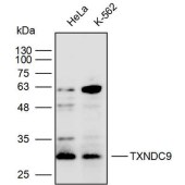 Solarbio K111768P Anti-TXNDC9 Polyclonal Antibody