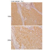 Solarbio K110933P Anti-PPP3R2 Polyclonal Antibody
