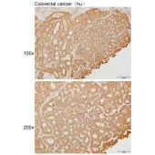 Solarbio K111638P Anti-KCNT1 Polyclonal Antibody