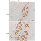 Solarbio K111870P Anti-SLC2A5 Polyclonal Antibody