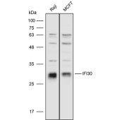 Solarbio K111734P Anti-IFI30 Polyclonal Antibody