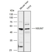 Solarbio K111936P Anti-NSUN7 Polyclonal Antibody