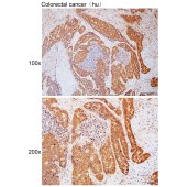 Solarbio K111790P Anti-PAK2 Polyclonal Antibody