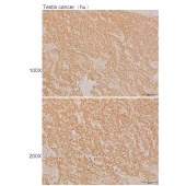 Solarbio K110587P Anti-DHCR24 Polyclonal Antibody