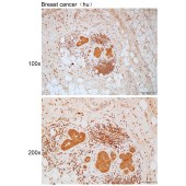 Solarbio K111744P Anti-PLCB1 Polyclonal Antibody