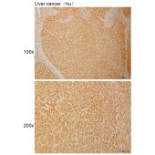 Solarbio K110971P Anti-VTI1B Polyclonal Antibody