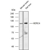 Solarbio K111956P Anti-HERC4 Polyclonal Antibody