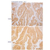 Solarbio K110574P Anti-TTK Polyclonal Antibody