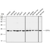 Solarbio K111964P Anti-ETFA Polyclonal Antibody