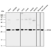 Solarbio K111798P Anti-RPS8 Polyclonal Antibody