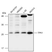 Solarbio K112098P Anti-TPK1 Polyclonal Antibody