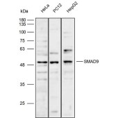 Solarbio K111791P Anti-SMAD9 Polyclonal Antibody