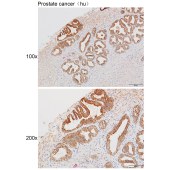 Solarbio K111486P Anti-SMO Polyclonal Antibody