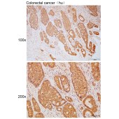 Solarbio K111757P Anti-ACOX1 Polyclonal Antibody
