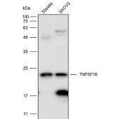 Solarbio K111674P Anti-TNFSF18 Polyclonal Antibody