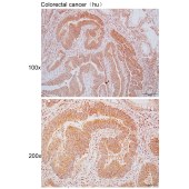 Solarbio K110614P Anti-PLS3 Polyclonal Antibody
