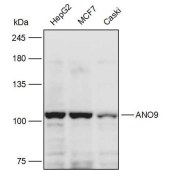 Solarbio K111490P Anti-ANO9 Polyclonal Antibody