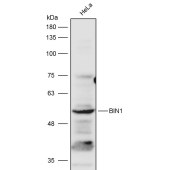Solarbio K111630P Anti-BIN1 Polyclonal Antibody