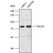 Solarbio K111242P Anti-TMCC2 Polyclonal Antibody