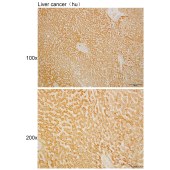 Solarbio K110527P Anti-WDR41 Polyclonal Antibody