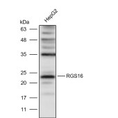 Solarbio K111605P Anti-RGS16 Polyclonal Antibody