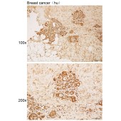 Solarbio K111885P Anti-USP15 Polyclonal Antibody