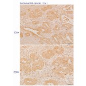 Solarbio K110580P Anti-ABI3BP Polyclonal Antibody