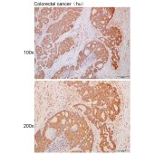 Solarbio K111676P Anti-KCNN2 Polyclonal Antibody