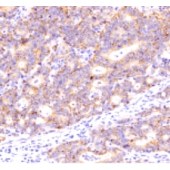 Solarbio K009994P Anti-Claudin 1 Polyclonal Antibody