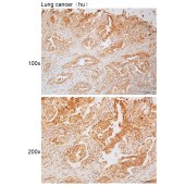 Solarbio K111773P Anti-SYT16 Polyclonal Antibody