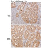 Solarbio K111446P Anti-SCHIP1 Polyclonal Antibody