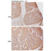 Solarbio K111500P Anti-RAPGEF3 Polyclonal Antibody