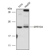 Solarbio K111437P Anti-SPRYD4 Polyclonal Antibody