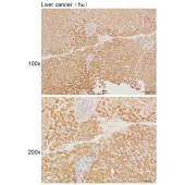 Solarbio K111636P Anti-GPR158 Polyclonal Antibody