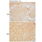 Solarbio K110528P Anti-INO80C Polyclonal Antibody