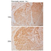 Solarbio K110987P Anti-LCA5 Polyclonal Antibody