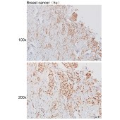 Solarbio K111496P Anti-ZKSCAN5 Polyclonal Antibody