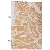 Solarbio K111102P Anti-ELOA Polyclonal Antibody