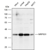 Solarbio K111951P Anti-MRPS31 Polyclonal Antibody
