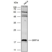 Solarbio K111705P Anti-SRP14 Polyclonal Antibody
