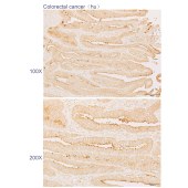 Solarbio K110589P Anti-ST3GAL2 Polyclonal Antibody