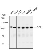 Solarbio K112136P Anti-OGA Polyclonal Antibody