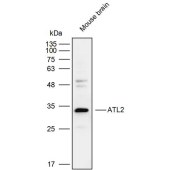 Solarbio K111800P Anti-ATL2 Polyclonal Antibody