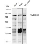 Solarbio K111955P Anti-TIMELESS Polyclonal Antibody