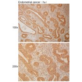 Solarbio K111000P Anti-KPNA5 Polyclonal Antibody