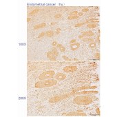 Solarbio K110589P Anti-ST3GAL2 Polyclonal Antibody